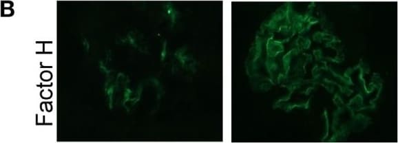 Detection of Mouse Complement Factor H by Immunocytochemistry/Immunofluorescence