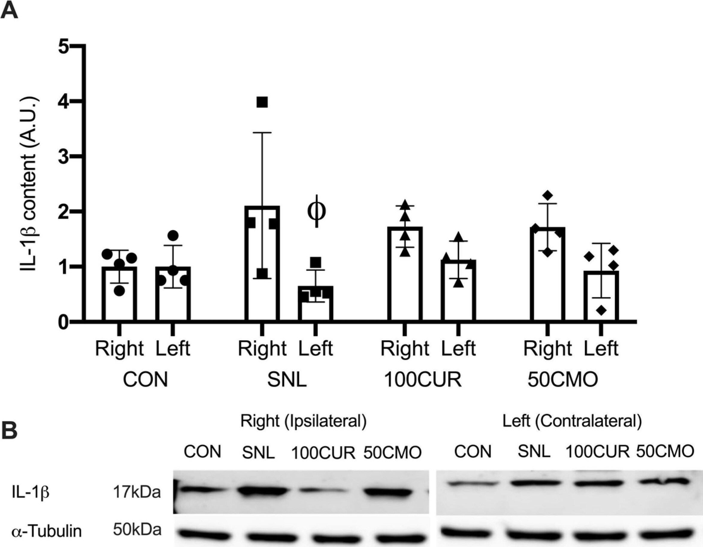 Detection of Rat IL-1 beta /IL-1F2 by Western Blot