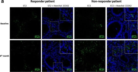 Detection of Human ST2/IL-33R by Immunocytochemistry/Immunofluorescence