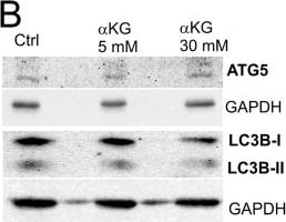 Detection of ATG5 by Western Blot