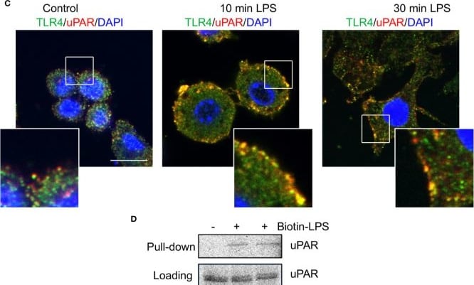 Detection of uPAR by Immunocytochemistry/ Immunofluorescence