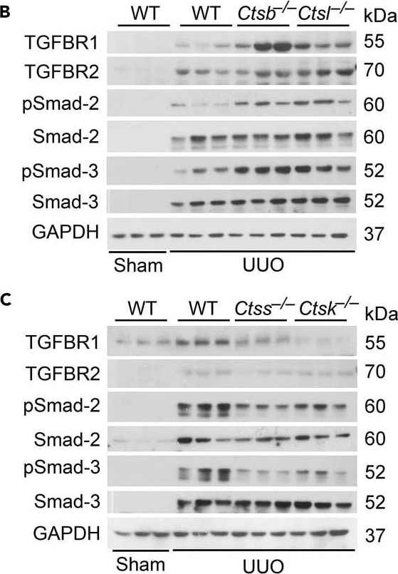 Detection of Mouse TGF-beta RII by Western Blot