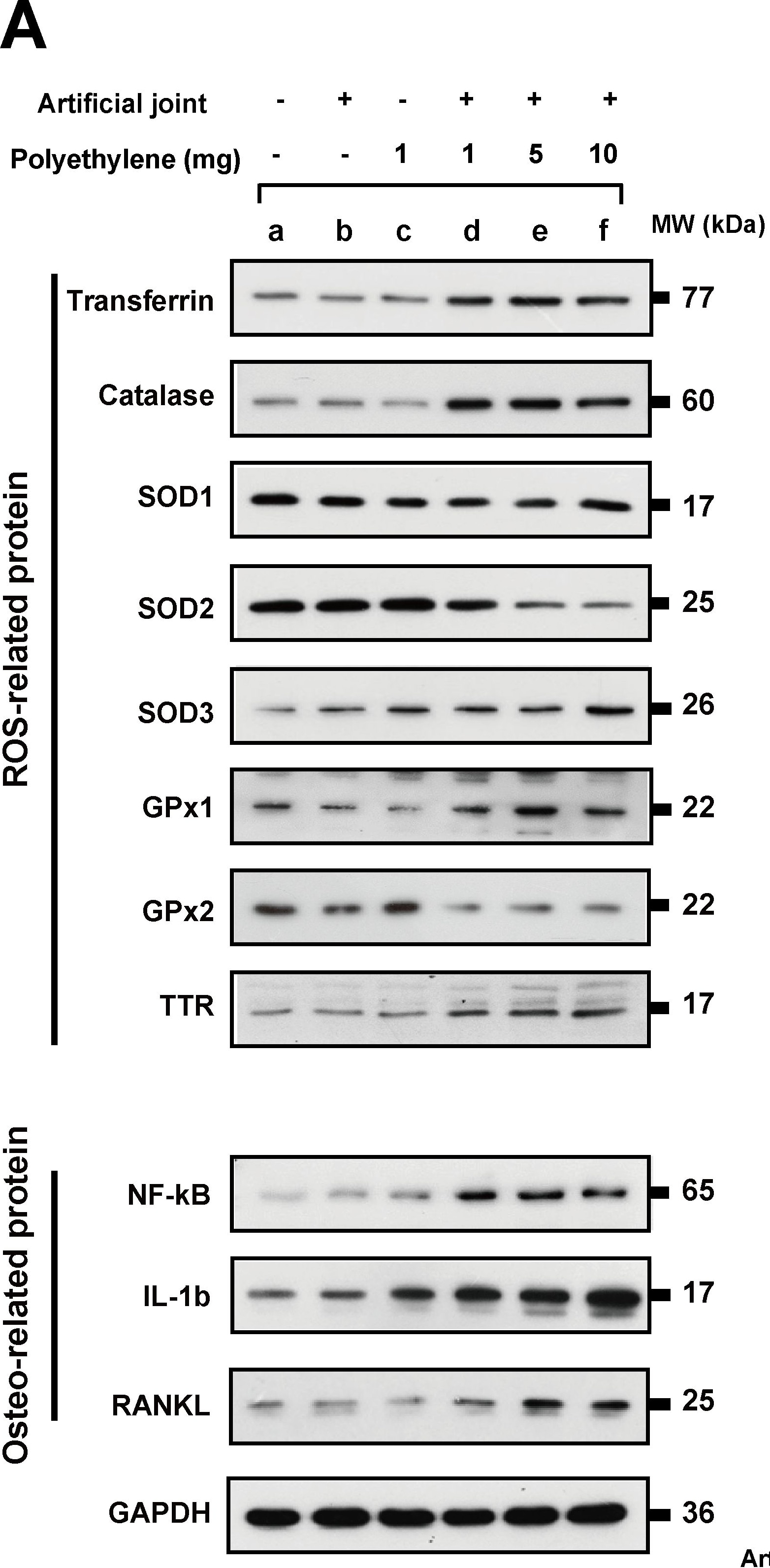 glutathione peroxidase 2 antibody Anti-Glutathione Peroxidase 2/GPX2 Antibody (A88736) main image 0