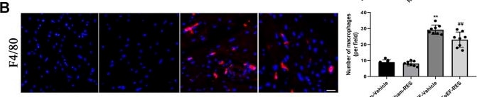 Detection of F4/80/EMR1 by Immunohistochemistry