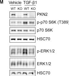 Detection of PKN2 by Western Blot