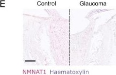 Detection of NMNAT-1 by Immunohistochemistry