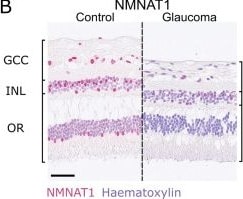 Detection of NMNAT-1 by Immunohistochemistry