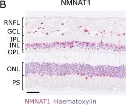 Detection of NMNAT-1 by Immunohistochemistry