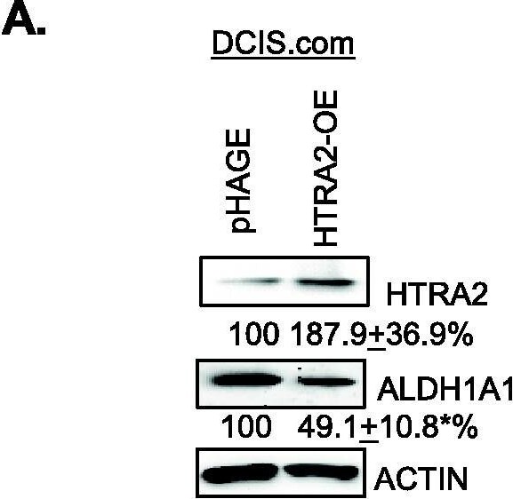 Detection of Human Aldehyde Dehydrogenase 1-A1/ALDH1A1 by Western Blot