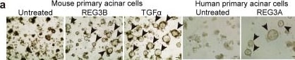 Detection of Reg3A by Immunohistochemistry
