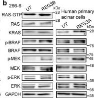 Detection of Reg3A by Western Blot
