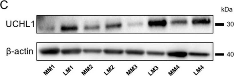 Detection of UCH-L1/PGP9.5 by Western Blot