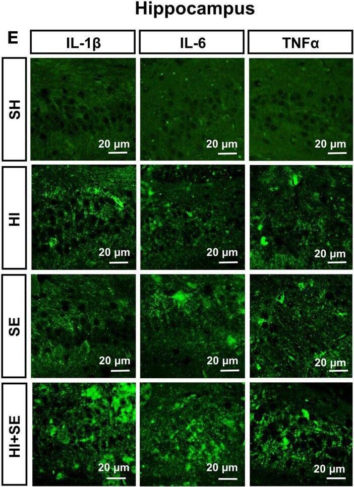 Detection of Mouse IL-1 beta/IL-1F2 by Immunohistochemistry