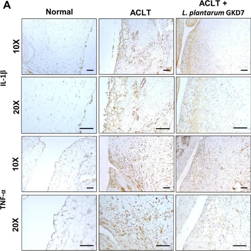 Detection of IL-1 beta /IL-1F2 by Immunohistochemistry