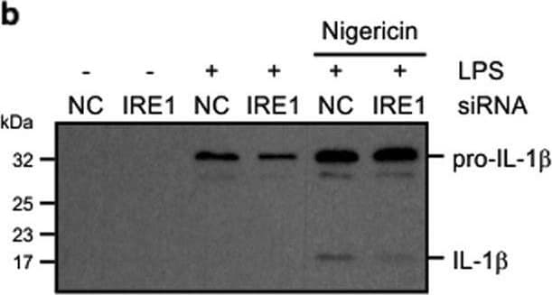 Detection of Human IL-1 beta /IL-1F2 by Western Blot