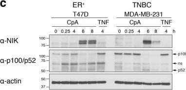 Detection of TNF-alpha by Western Blot