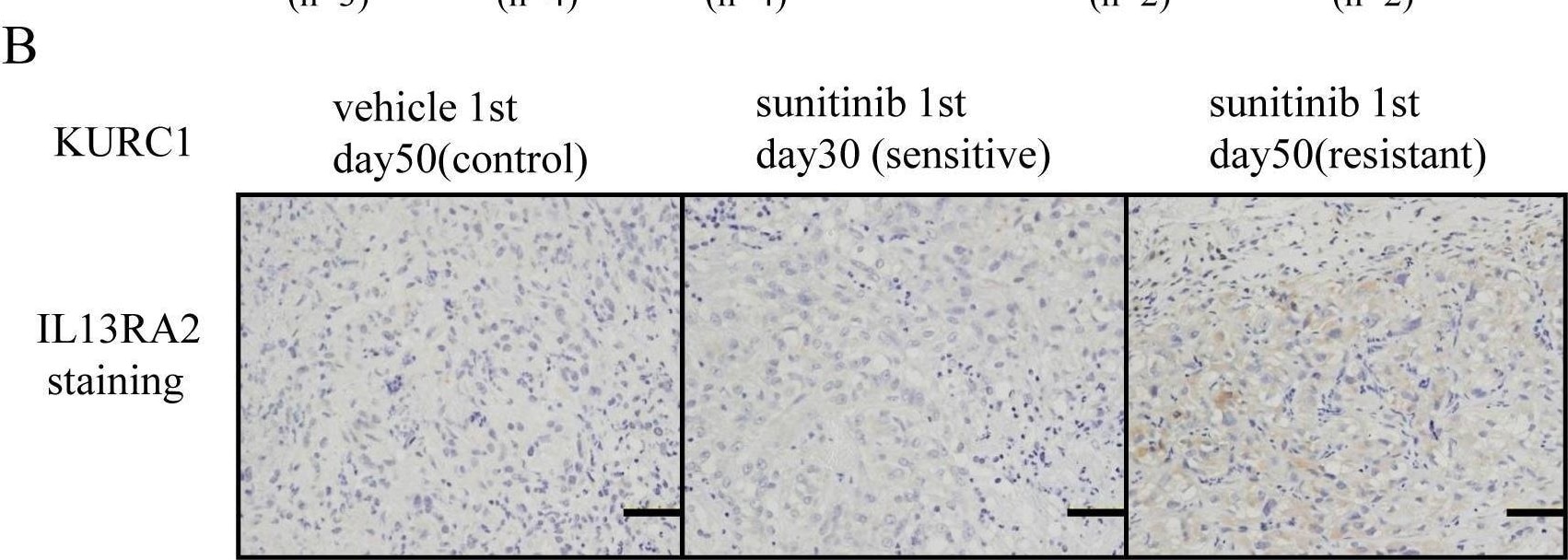 Detection of IL-13 R alpha 2 by Immunohistochemistry