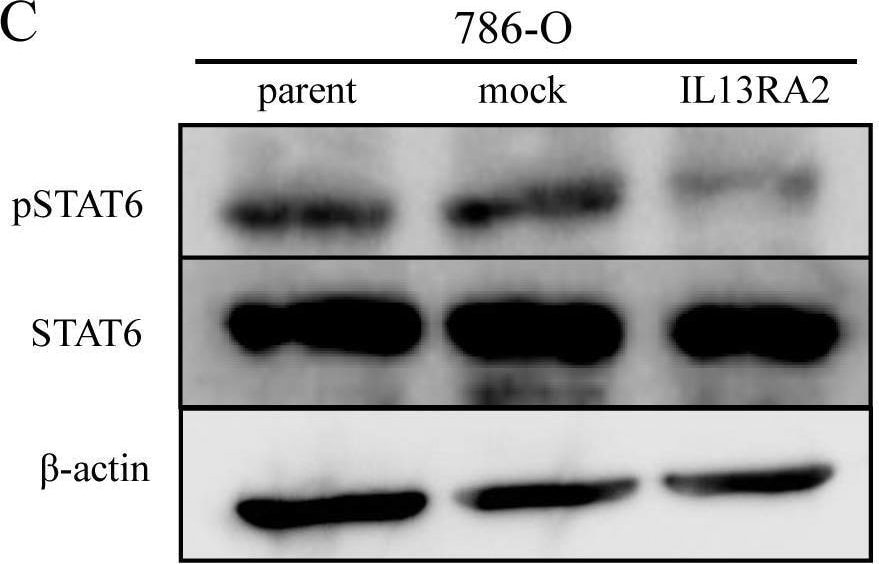 Detection of IL-13 R alpha 2 by Western Blot