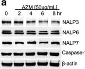 Detection of GM-CSF by Western Blot
