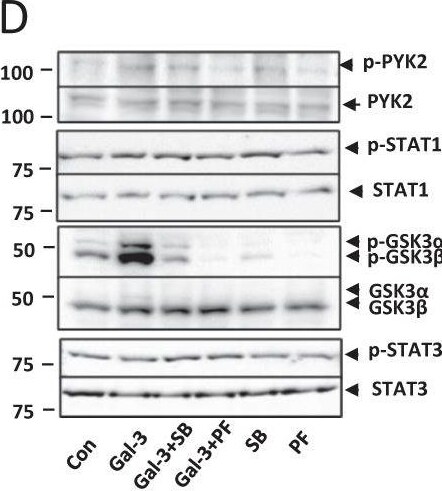 Detection of Phospho-PYK2/FAK2 (Y402) by Western Blot