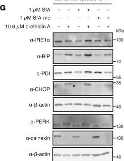 Detection of gnzwt4vp4jf4h7neevex.jpg by Western Blot