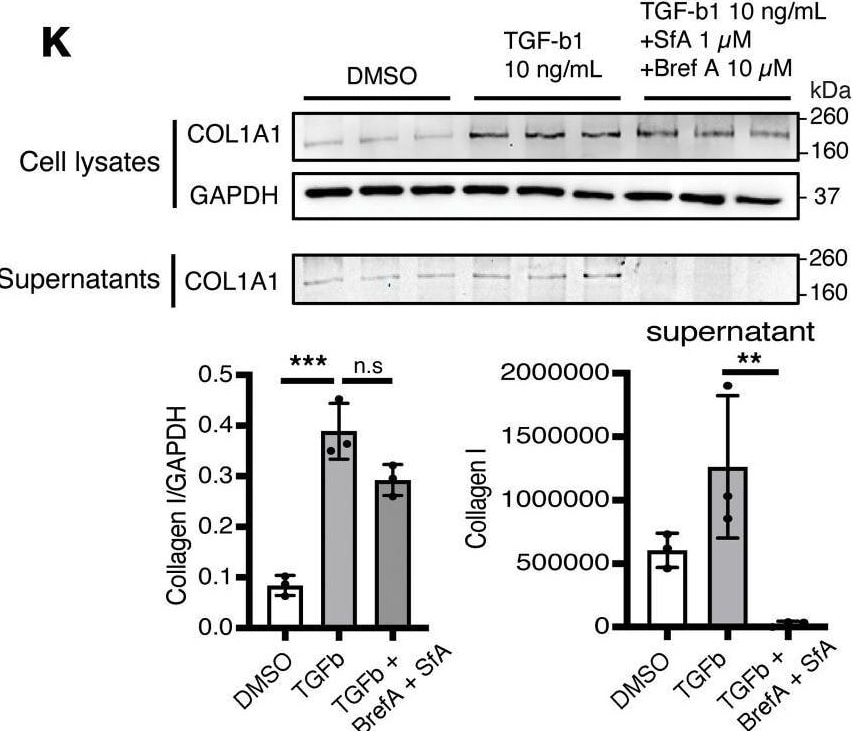 Detection of il7gn6ioyvz0zygdjdsk.jpg by Western Blot