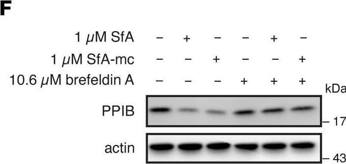 Detection of Pro-Collagen I alpha 1 by Western Blot