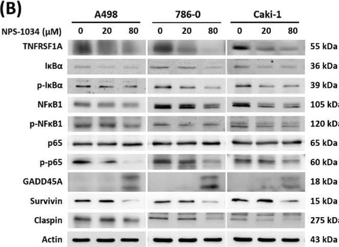 Detection of TNF RI/TNFRSF1A by Western Blot