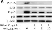 Detection of TNF RI/TNFRSF1A by Western Blot