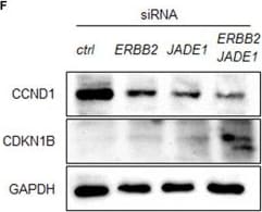 Detection of Jade-1/PHF17 by Western Blot