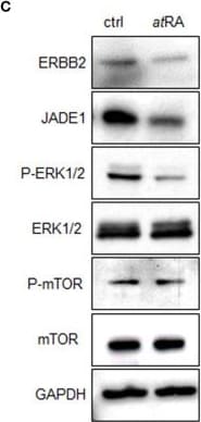 Detection of Jade-1/PHF17 by Western Blot