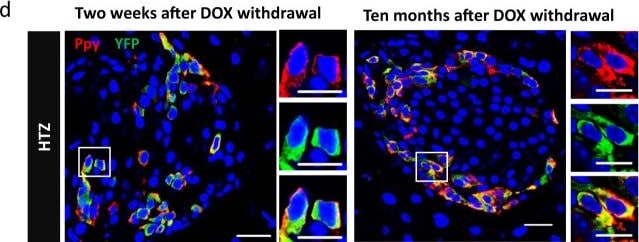 Detection of h1jdmvgtv2eh2nwjjhah.jpg by Immunohistochemistry
