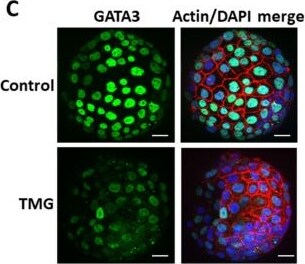 Detection of GATA-3 by Immunocytochemistry/ Immunofluorescence