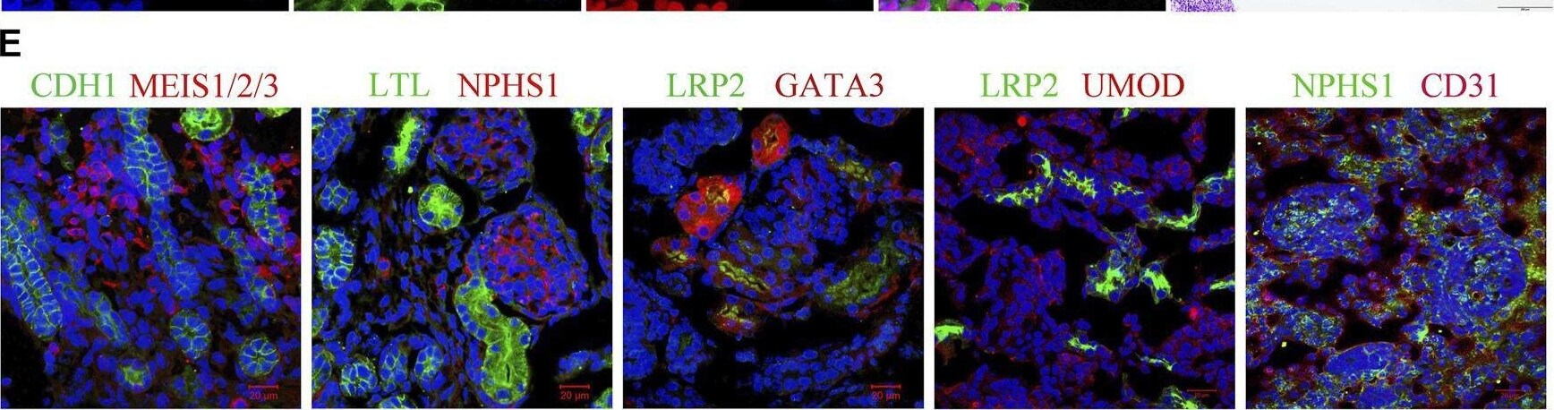 Detection of GATA-3 by Immunohistochemistry