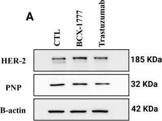 Detection of PNP by Western Blot