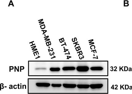 Detection of PNP by Western Blot