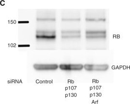 Detection of Human RB1 by Western Blot