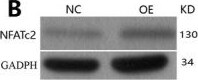 Detection of drembtgr66hzstlf4xjk.jpg by Western Blot