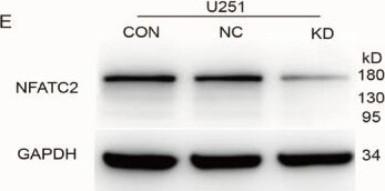 Detection of NFATC2 by Western Blot