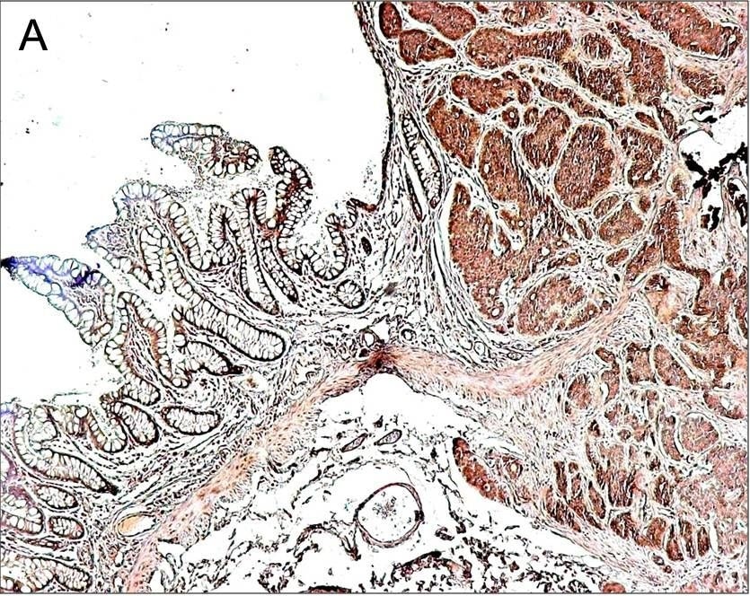 Detection of Human CTGF/CCN2 by Immunohistochemistry