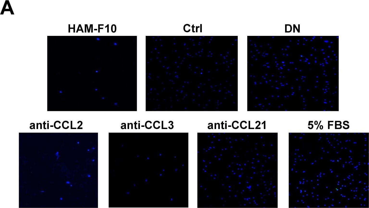 Detection of CCL3/MIP-1 alpha by Immunocytochemistry/ Immunofluorescence