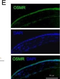Detection of OSMR beta by Immunohistochemistry