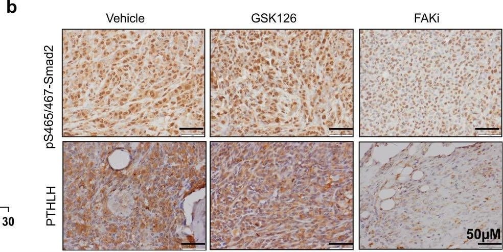 Detection of PTHLH/PTHrP by Immunohistochemistry