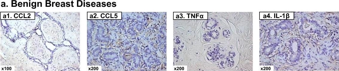 Detection of Human CCL2/JE/MCP-1 by Immunohistochemistry
