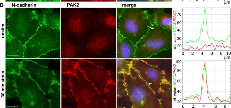 Detection of PAK2 by Immunocytochemistry/ Immunofluorescence