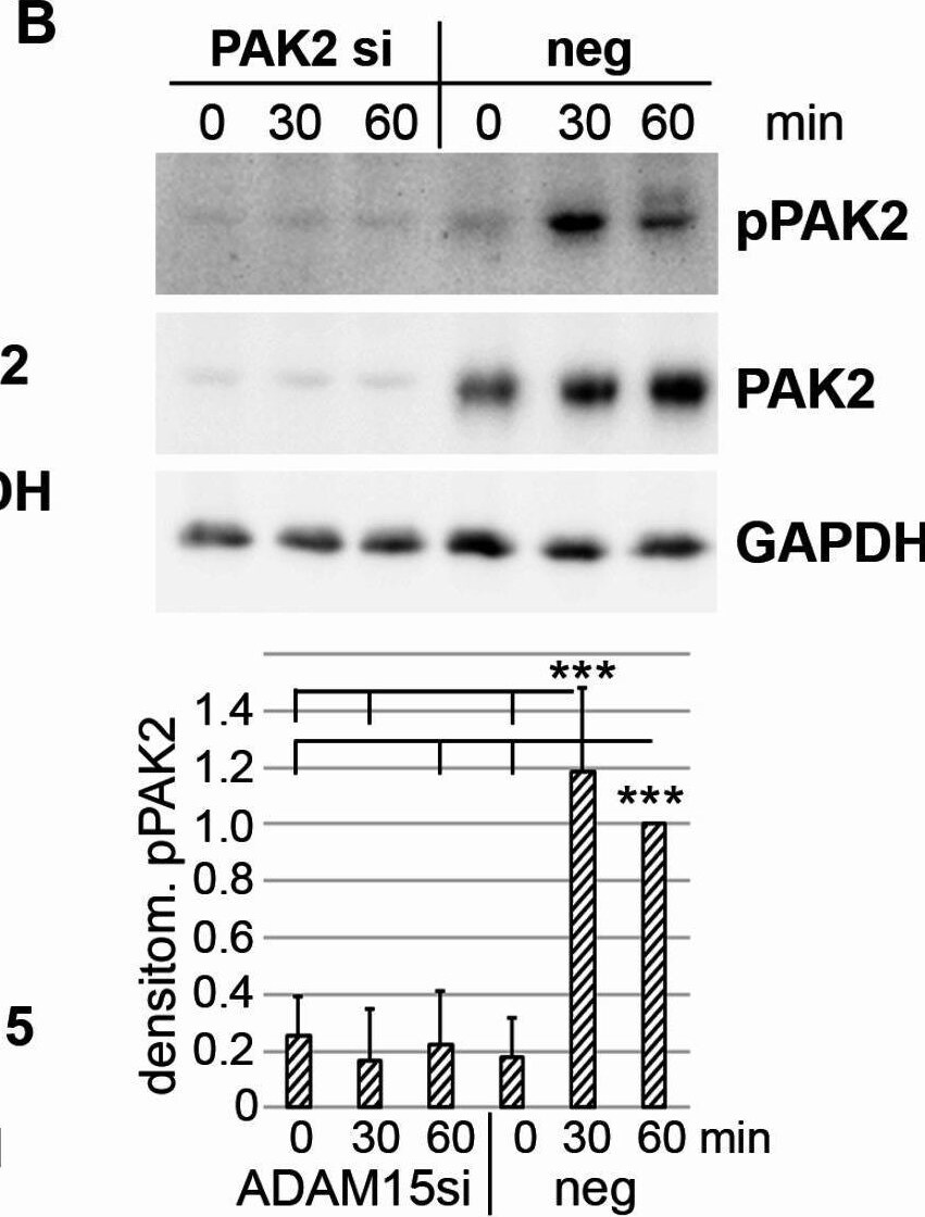 Detection of erw2itdfglz6sbdcfwsn.jpg by Western Blot