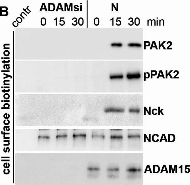 Detection of PAK2 by Western Blot