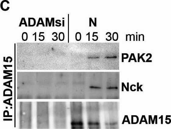 Detection of PAK2 by Western Blot