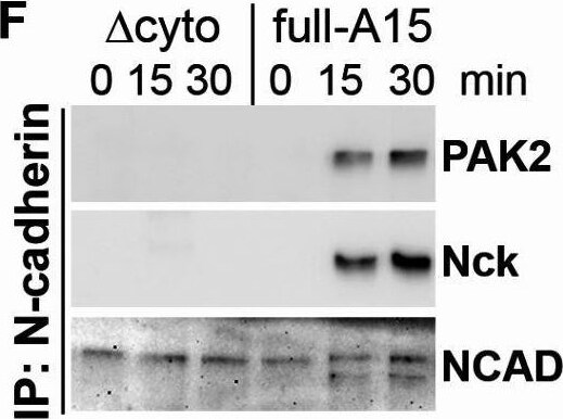 Detection of PAK2 by Western Blot