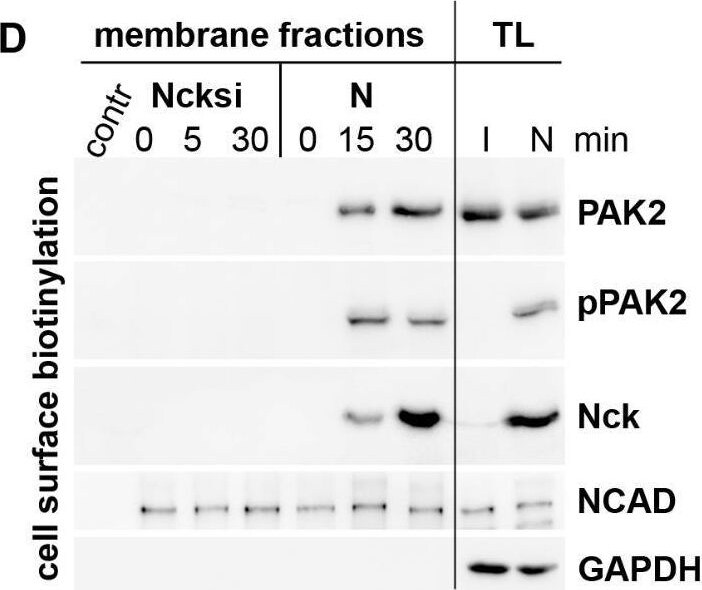 Detection of PAK2 by Western Blot